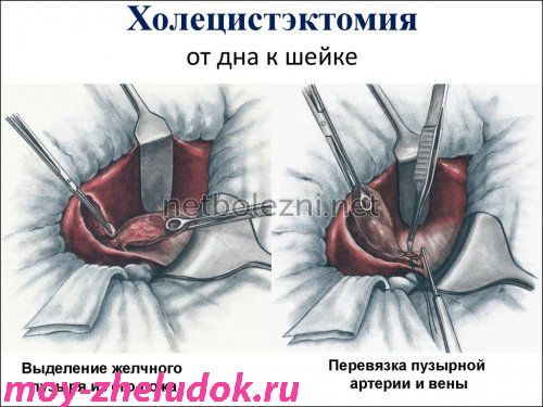 Как происходит удаление