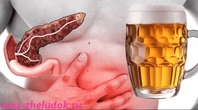Алкогольный панкреатит: как алкоголизм вызывает воспаление поджелудочной железы